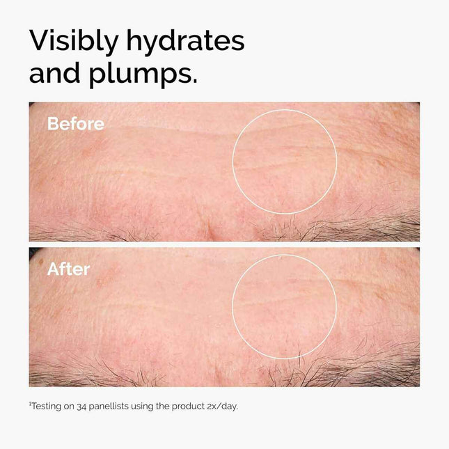 THE Ordinary Hyaluronic Acid 2 B5 Sérum Ácido Hialurónico Unisex, 30 ml