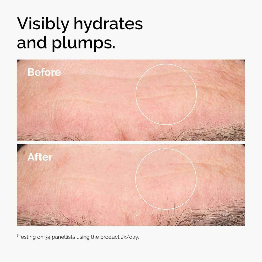 THE Ordinary Hyaluronic Acid 2 B5 Sérum Ácido Hialurónico Unisex, 30 ml