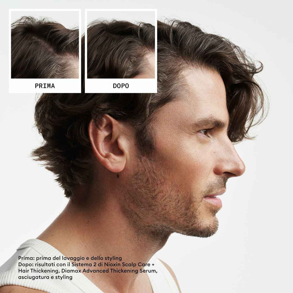 Nioxin Sistema 2 - Kit - Tratamiento Para Cabello Natural Con Debilitamiento Avanzado 3 U Unisex
