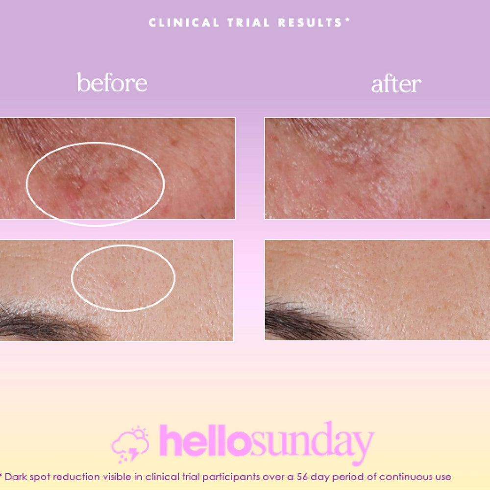 Hello Sunday – Face Serum for Unisex, 30 ml
